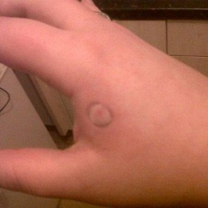 Turtle bite - yummy.p]