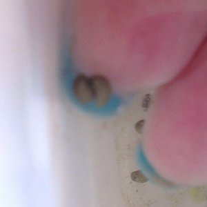 Twins......going bean shaped already....have about 12 pairs like this.....so exciting