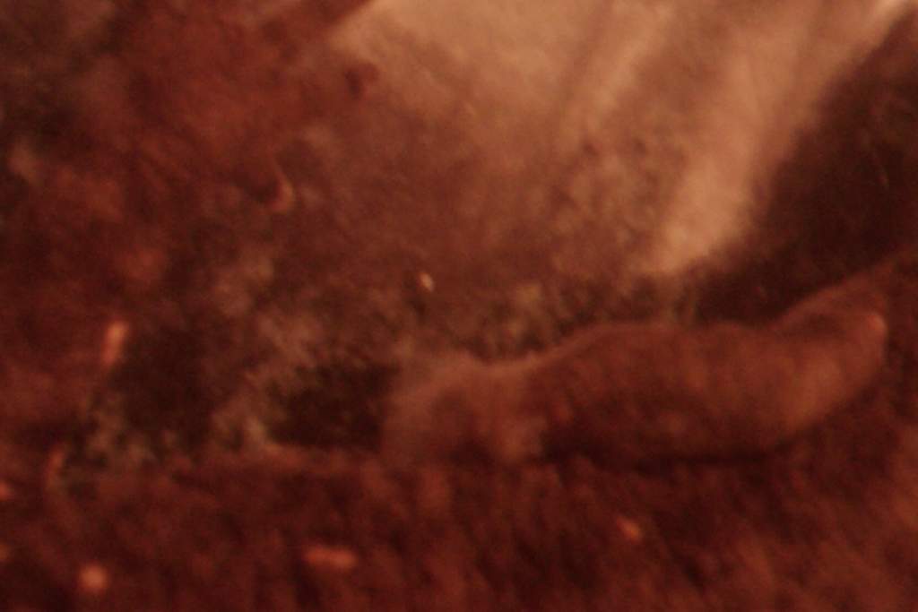 Fungal Infection