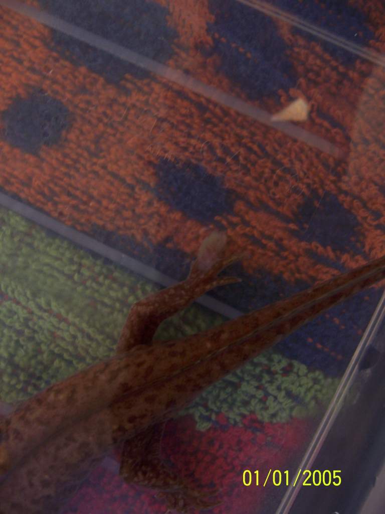 right toes , 2 of her toes seem like degenerating and linking up by the fluffy fungus?