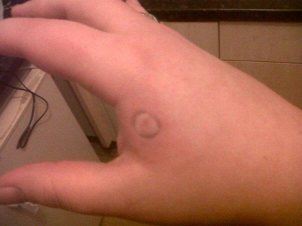 Turtle bite - yummy.p]